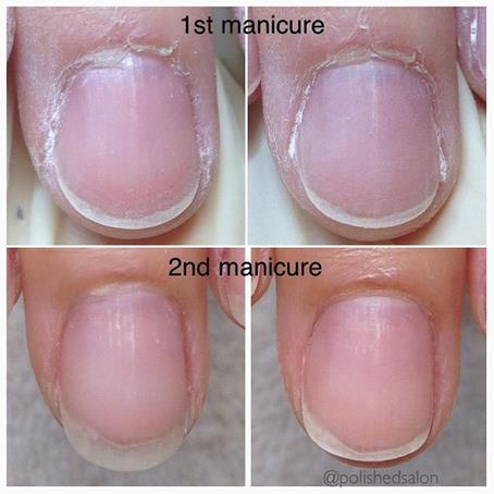 How to fix: naughty nails and crusty cuticles – 